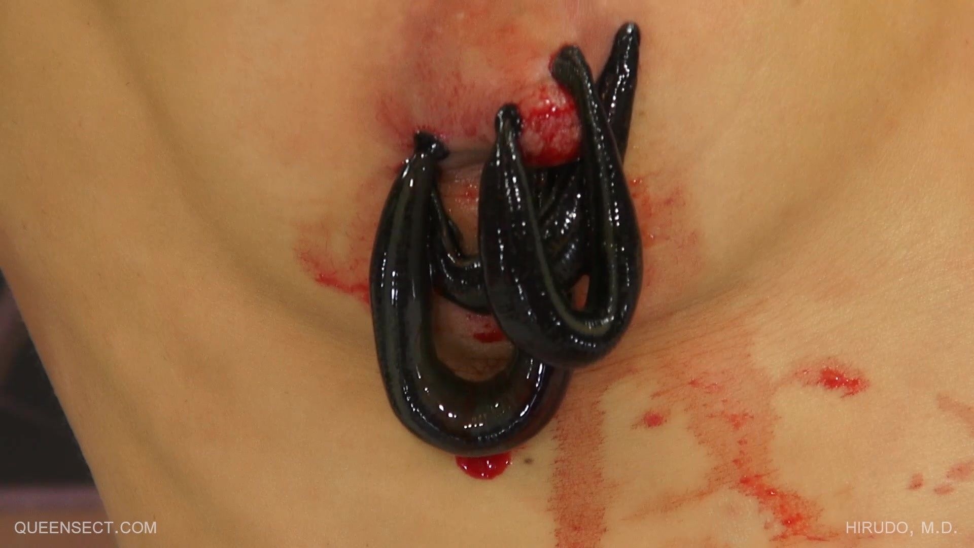 Hirudo, M.D. bdsm xxx video [2022, QueenSnake.com, Insects, Bdsm, Orgasm]
